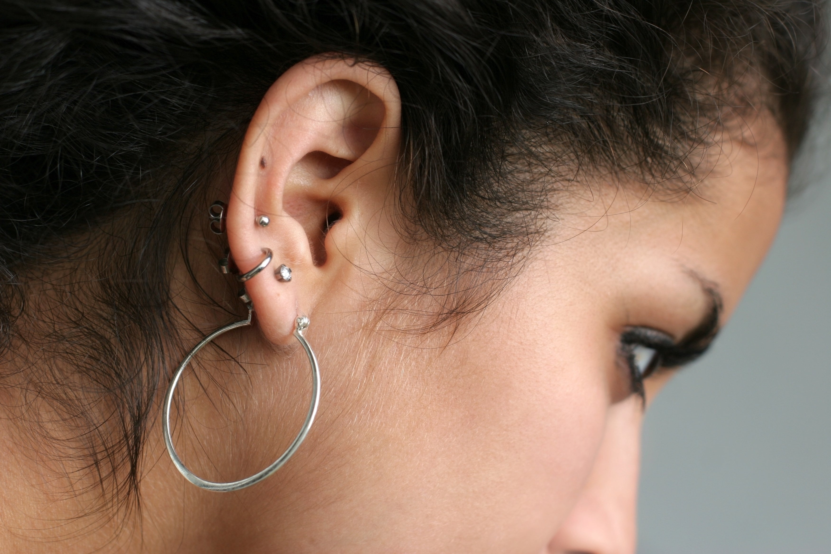 Can Piercings Cause Scars?