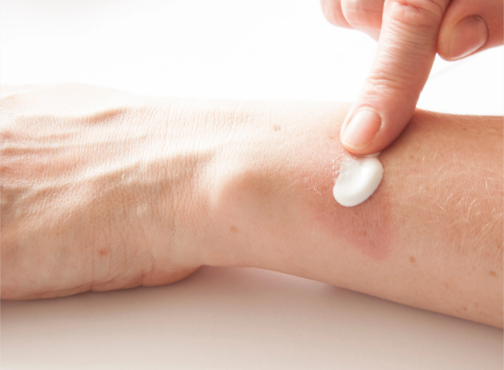 5 Things To Consider When Picking A Scar Product