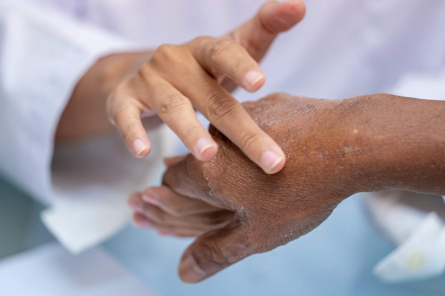 Common Mistakes That Make Dry Skin Worse (& How To Avoid Them) | what causes dry skin, what to avoid with dry skin, what makes dry skin worse