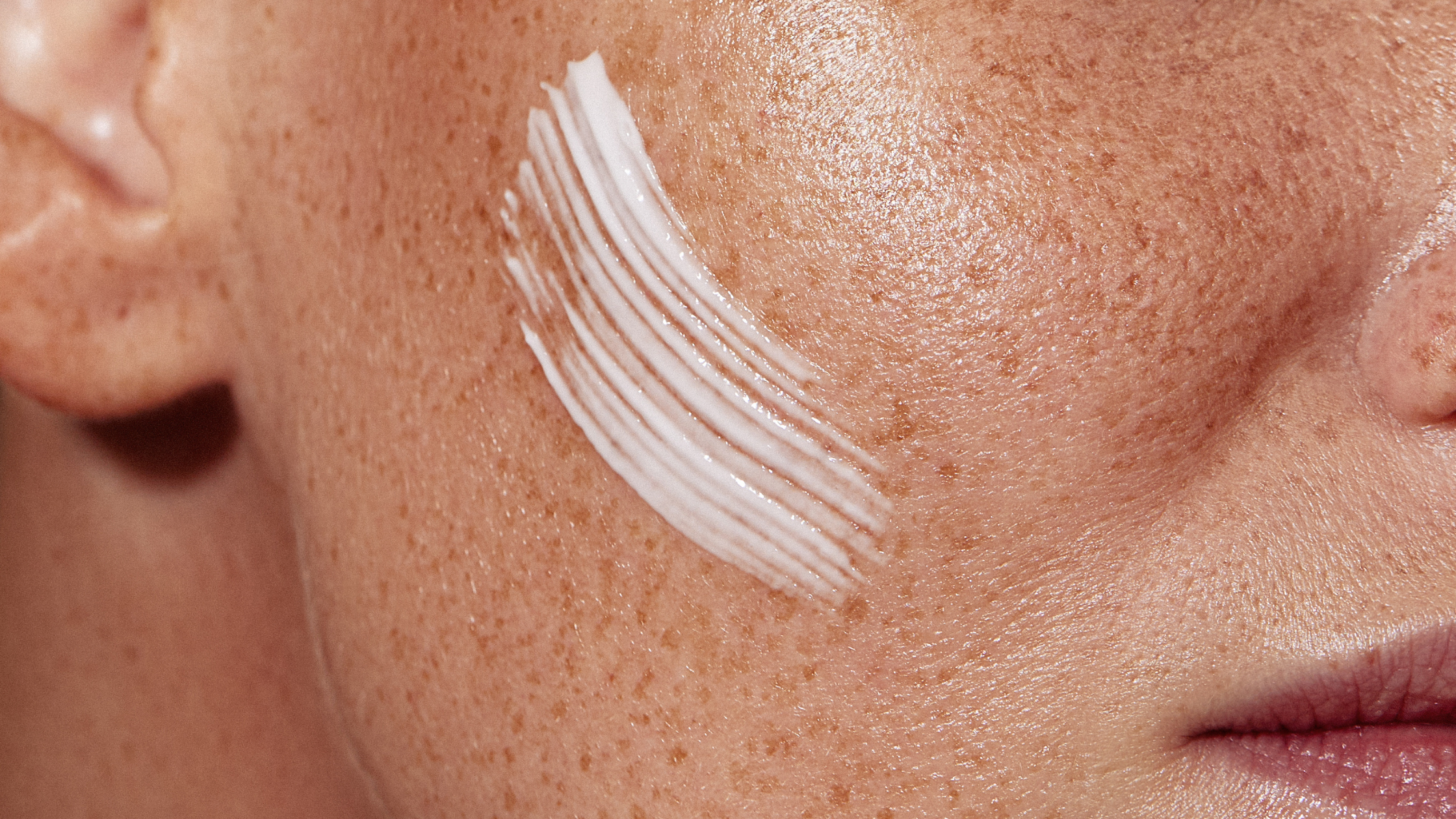 Restore & Glow: How Skin Recovery Cream Heals and Hydrates After Microneedling & Dermaplaning