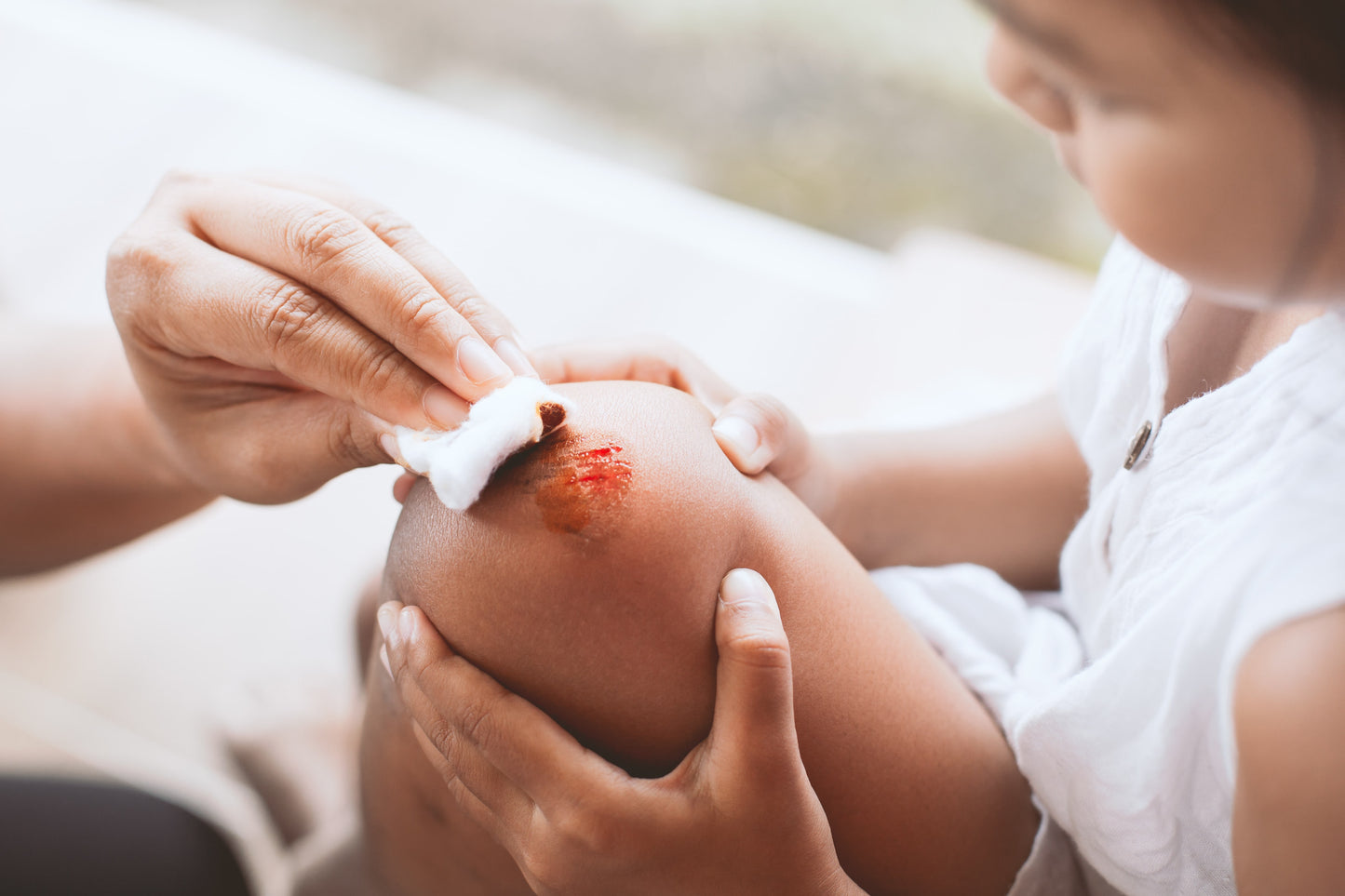 What is the Best Scar Cream for Kids?