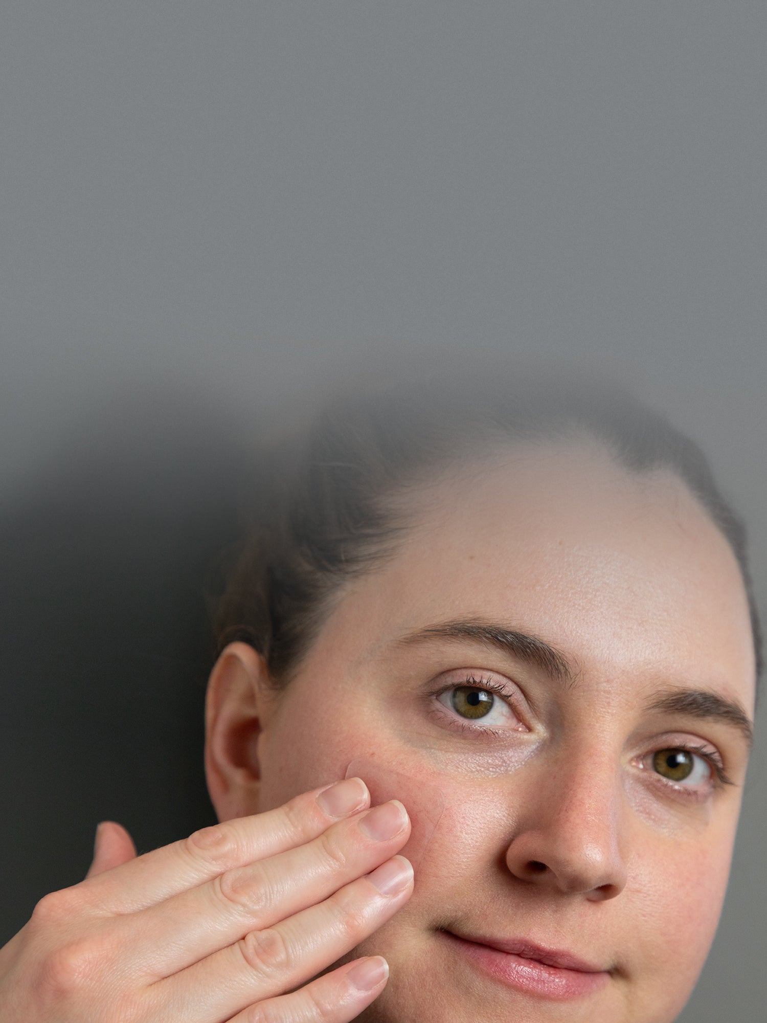 Next-Level Support for Mohs, Liposuction, and Other Small Scars