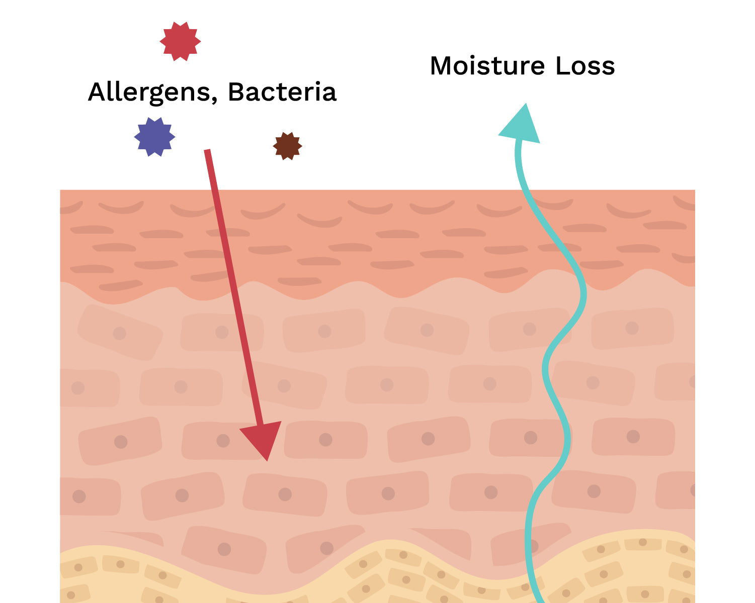 Diagram showing how eczema's skin barrier is affected from extreme moisture loss increasing allergens and bacteria into the skin