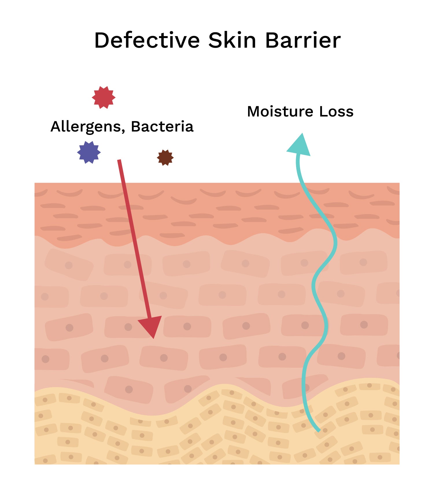 Diagram showing how eczema's skin barrier is affected from extreme moisture loss increasing allergens and bacteria into the skin
