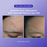 RejûvaSil Silicone Scar Gel