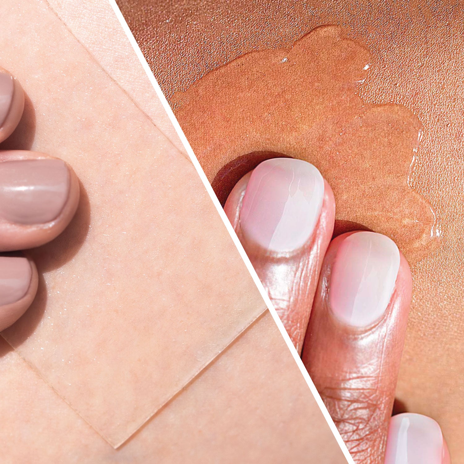 Applying Scar Heal Kit, Rejuvaskin Scar Management