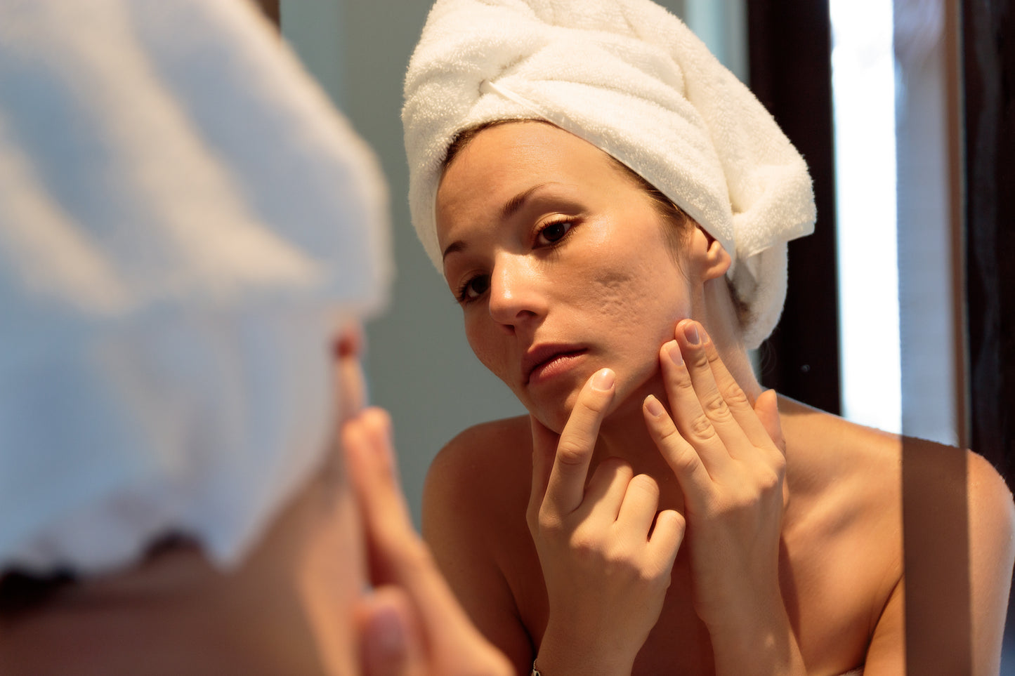 How To Treat Acne Scarring In Adults