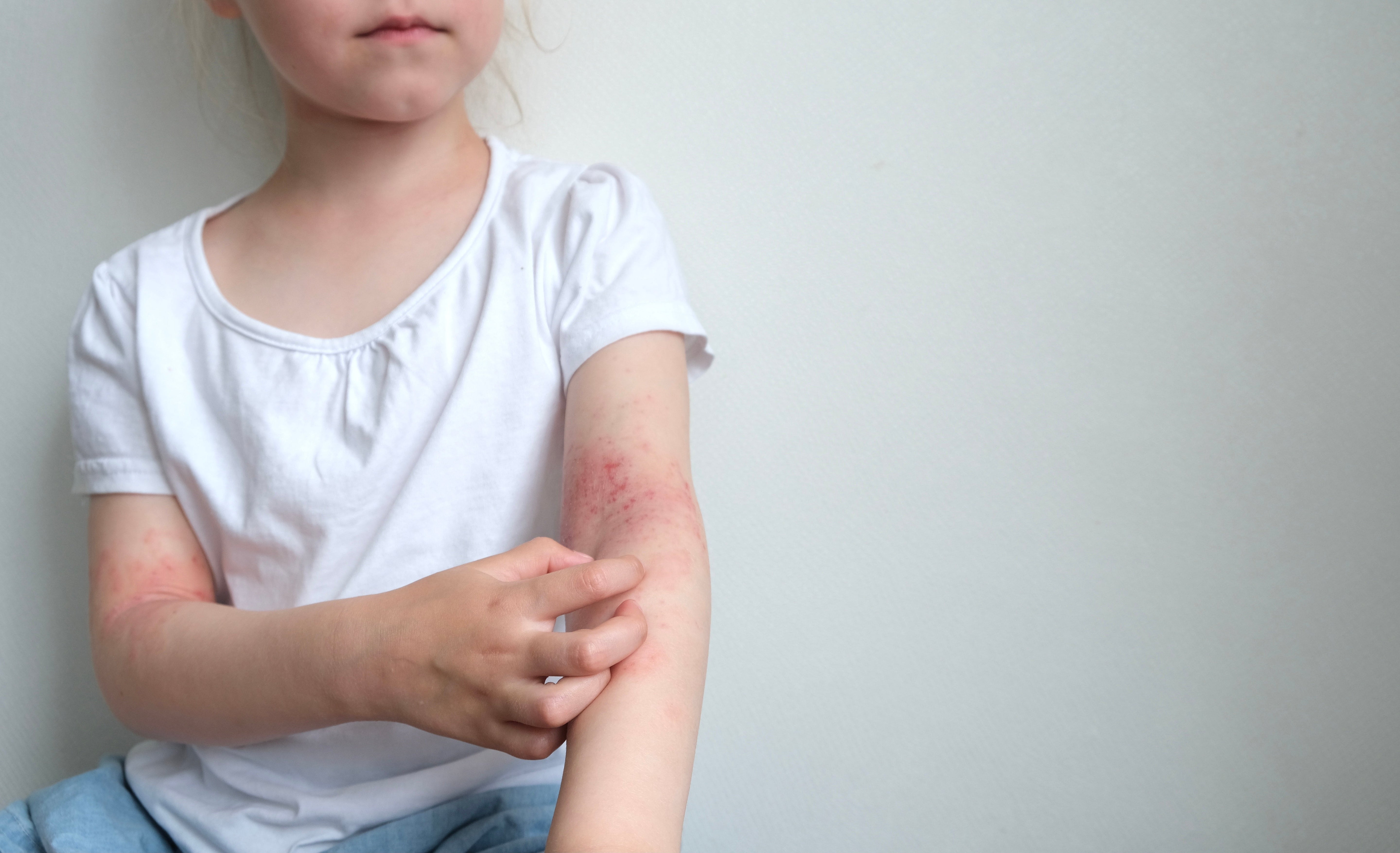 The Perfect Holiday Gift for Kids with Eczema: Comfort They Can Feel