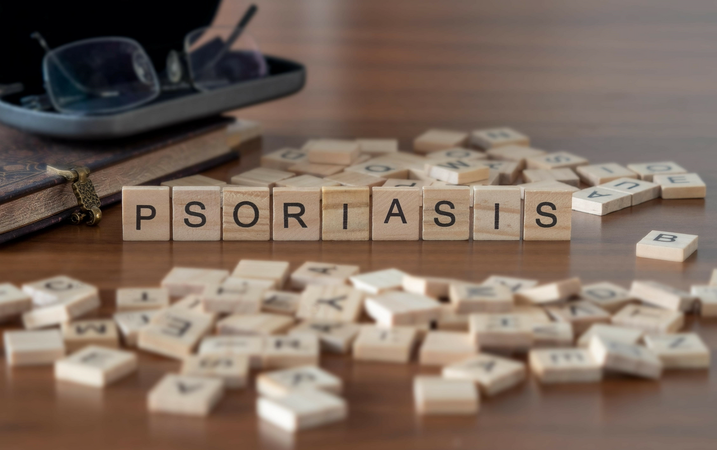 8 Tips For Managing Your Psoriasis