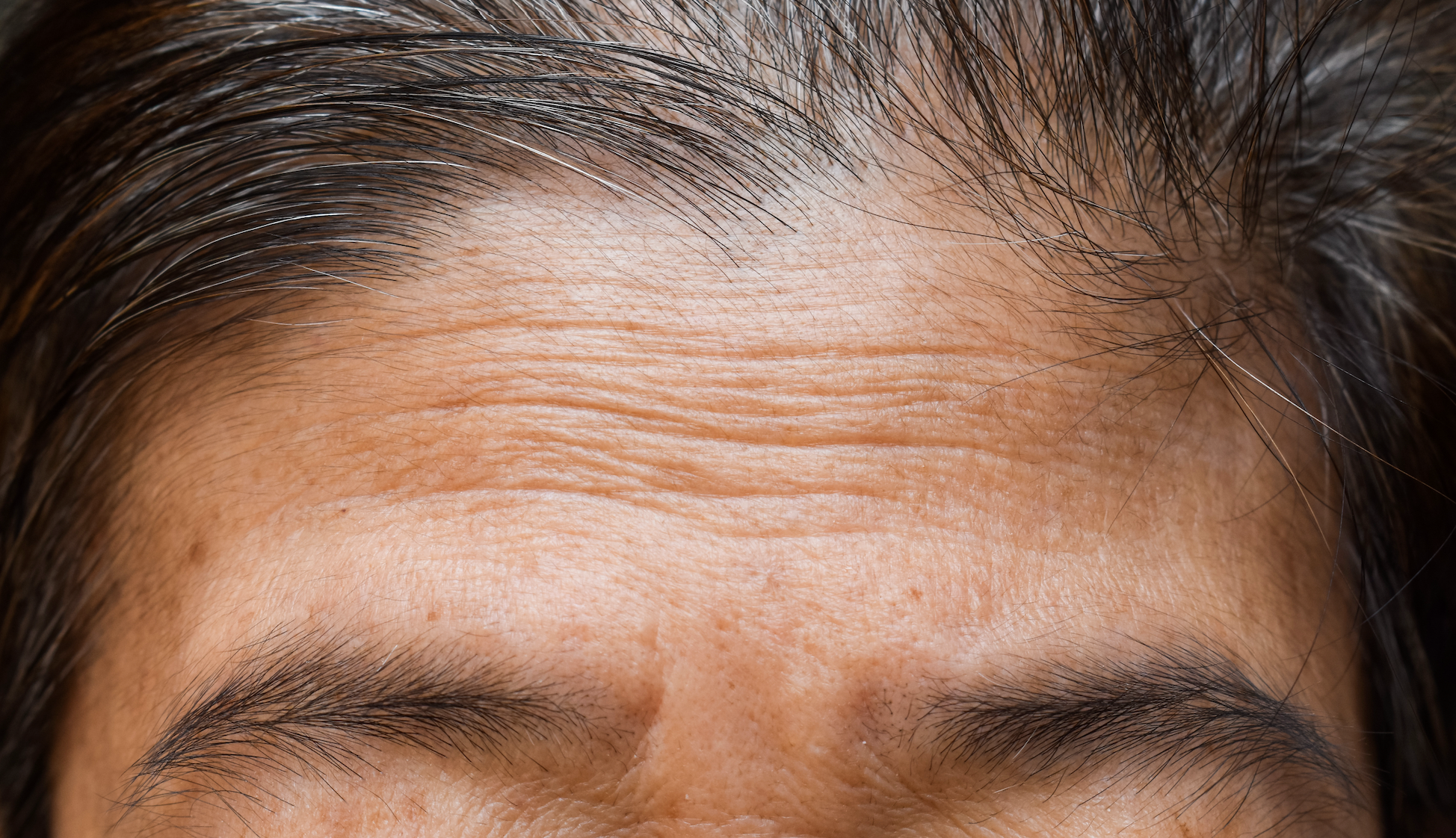 What Are the Most Common Signs of Aging?