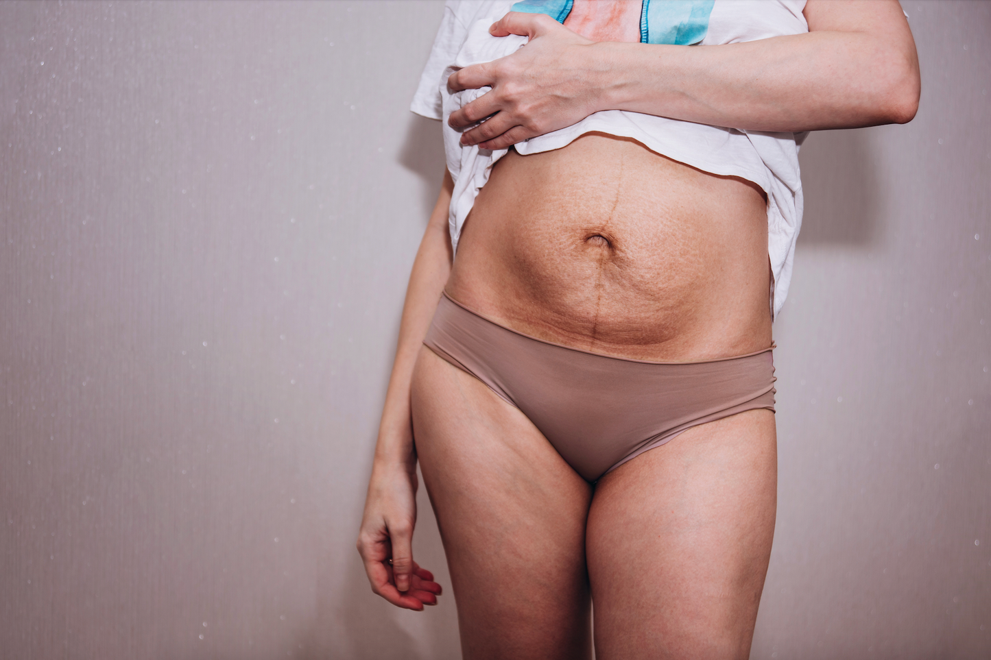 Foto de plus size overweight woman with stretches marks on her
