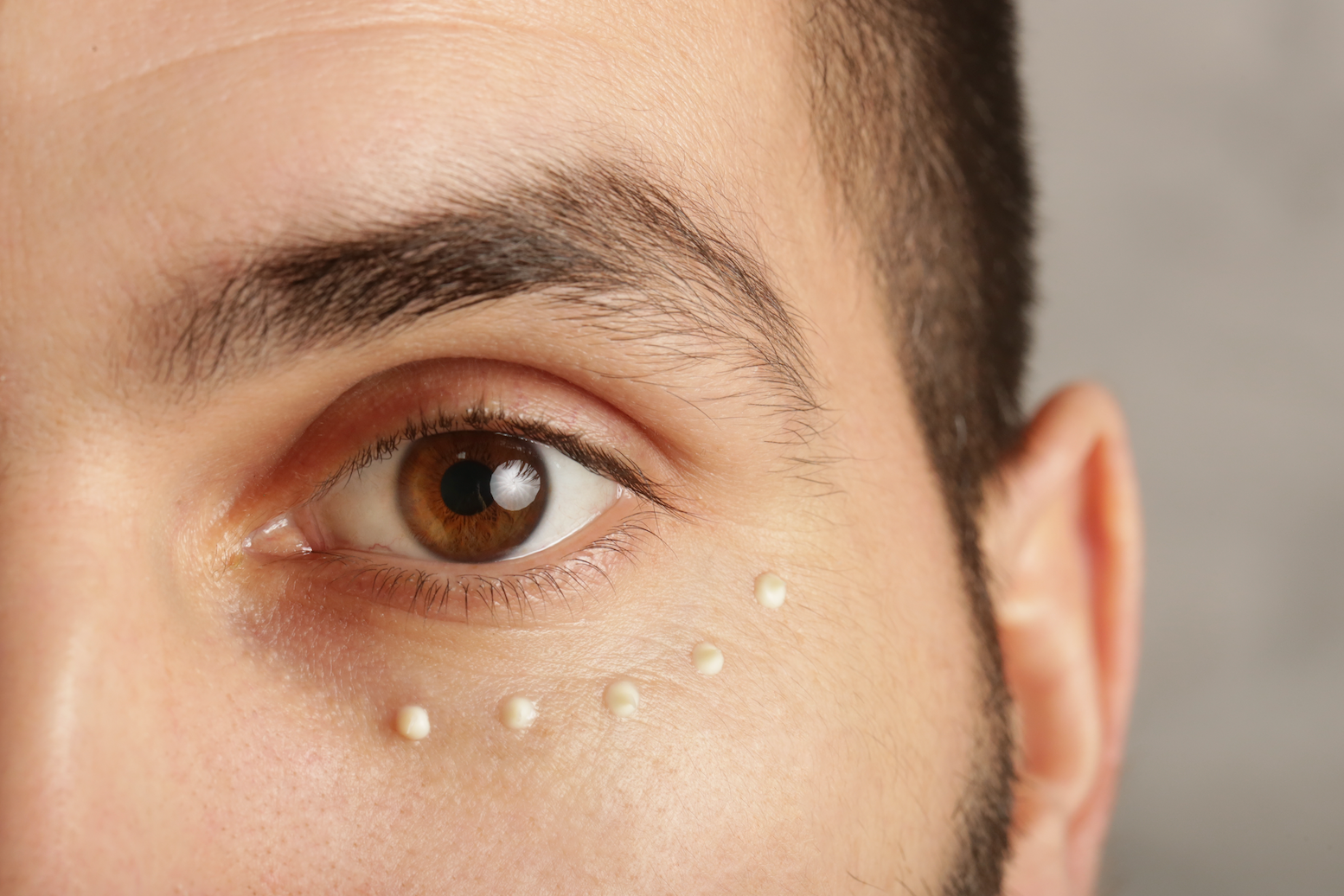 Does Eye Cream Really Matter?