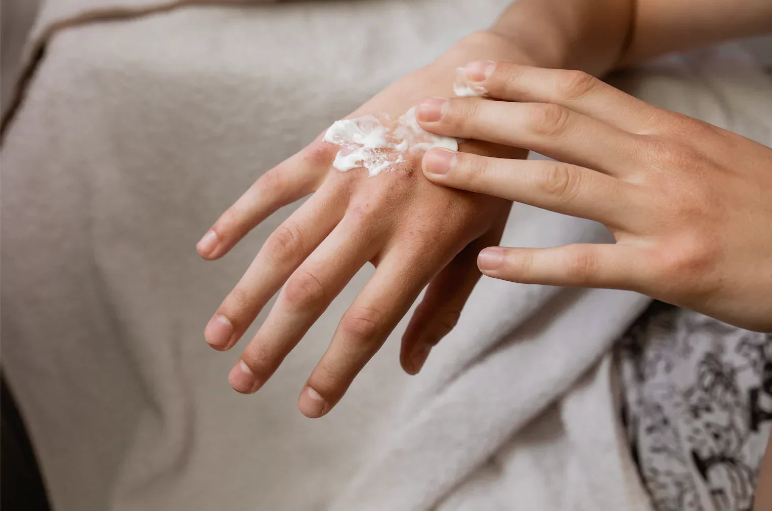 Building an Eczema-Friendly Skincare Routine