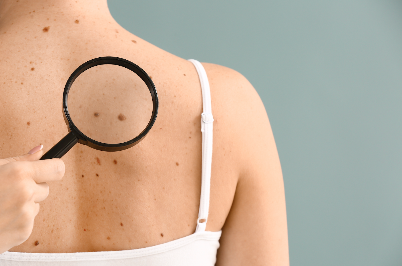 Debunking Skin Cancer Myths & Misconceptions
