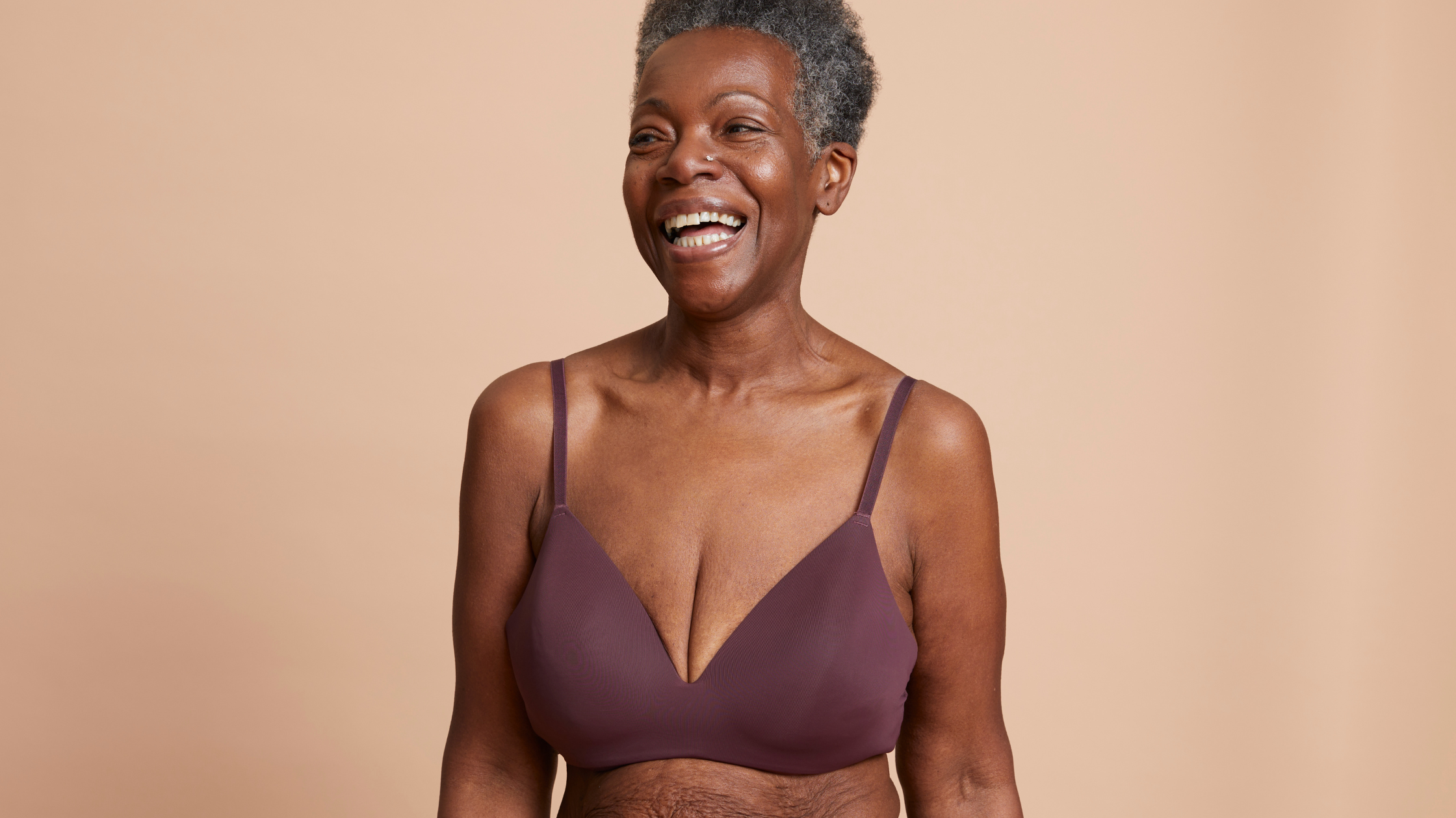 Are Stretch Marks in Your DNA? How Genetics & Skin Type Predict Your Risk