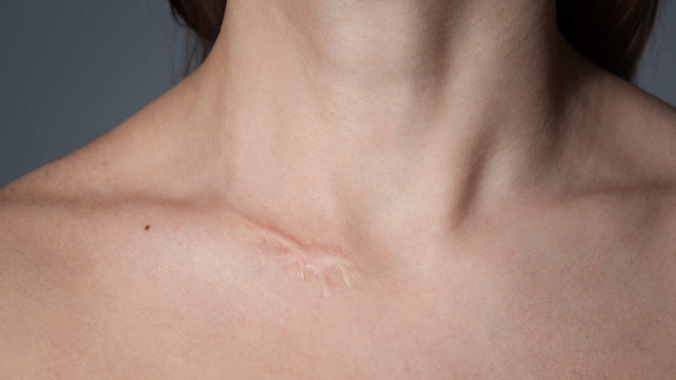 When to See a Specialist: Identifying Red Flags That Your Scar Isn’t Healing Properly