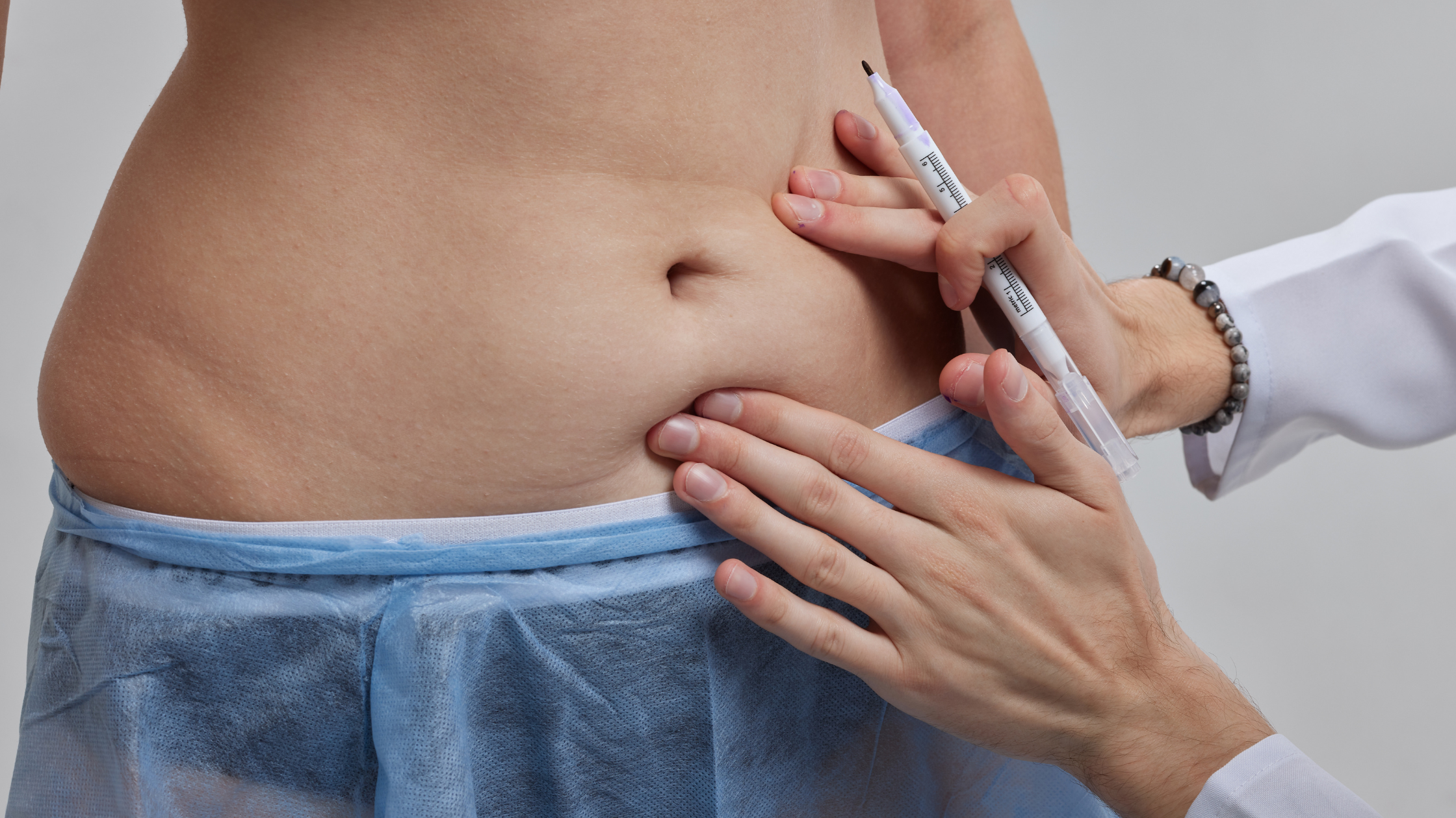 The Ultimate Guide to Tummy Tuck Scar Care with Rejuvaskin