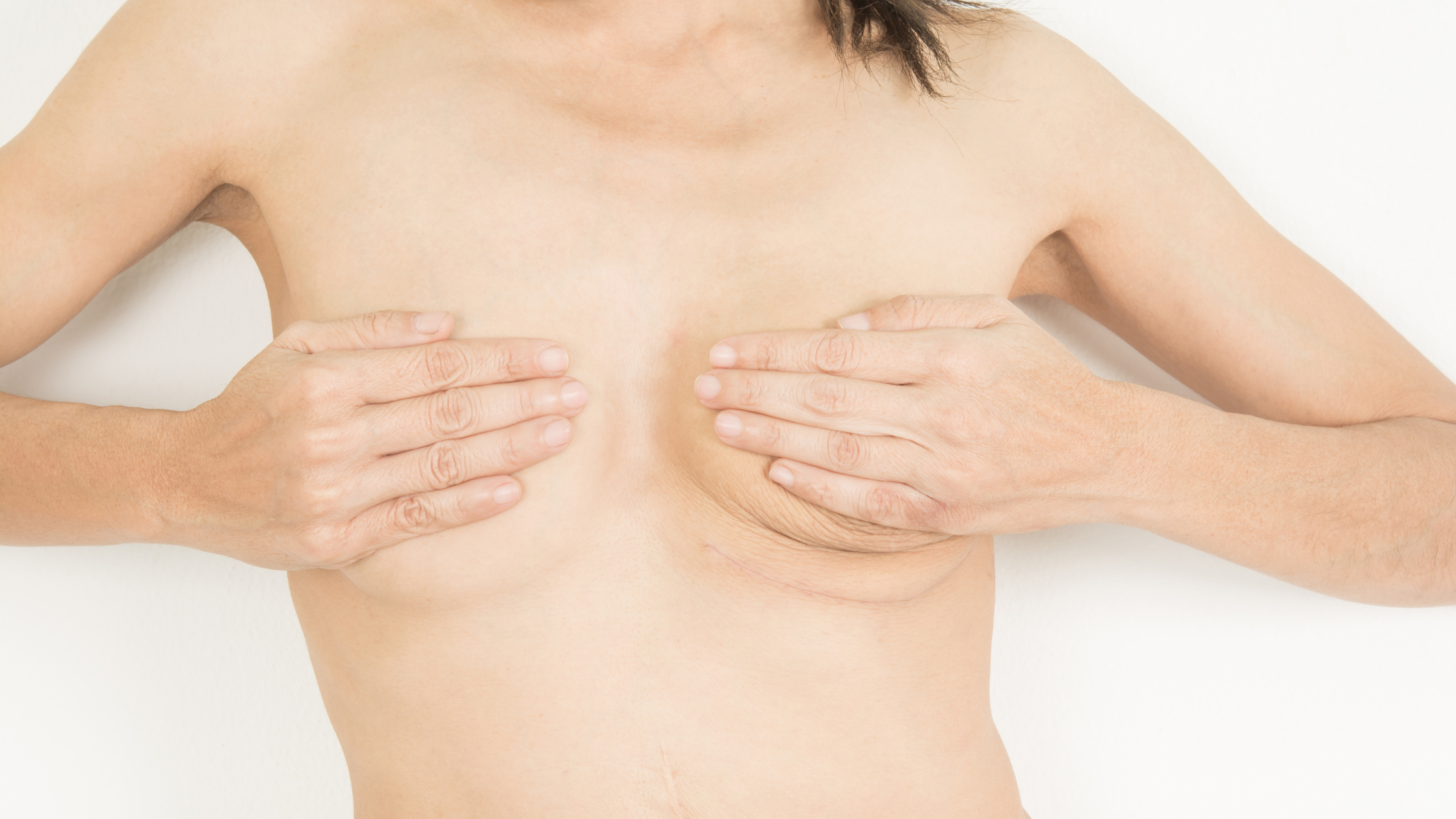 Breast Surgery Scar Healing Guide: What to Expect & How to Care for Your Skin