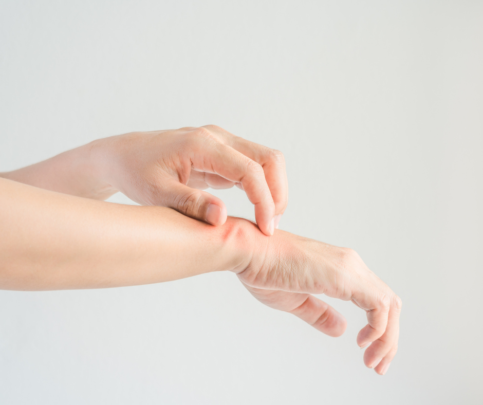 Everything You Need to Know About Eczema: Causes, Symptoms, and Treatment