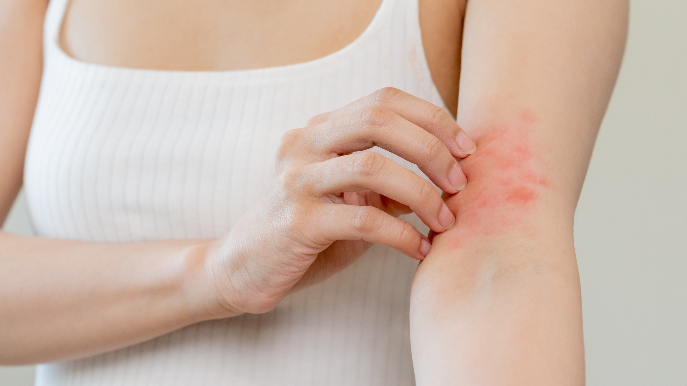 What Causes Eczema? And How Rejuvaskin Products Can Help