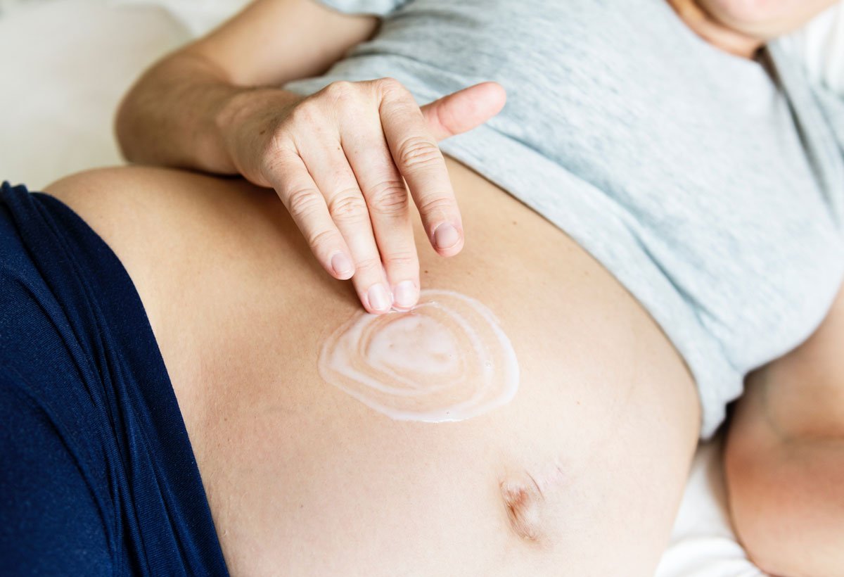 Tips for Preventing Stretch Marks While Pregnant