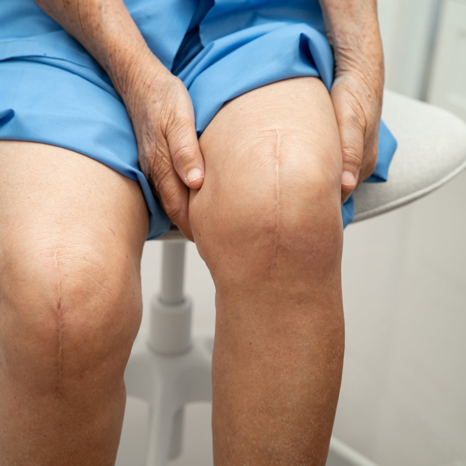 Surgical Scar Type