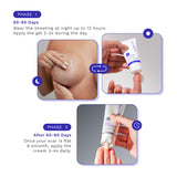 Breast Procedure Scar Bundle