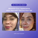 RejûvaSil Silicone Scar Gel