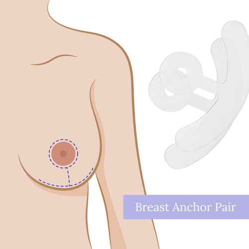 Anchor Pair Kit